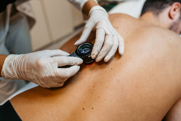 How to Book a Melbourne Skin Cancer Check Near You with Confidence Melbourne Skin Cancer Check